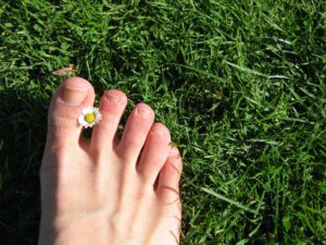 Can Sweaty Feet Cause Toenail Fungus? Here’s What You Need to Know Laser Nail Therapy wants to put your mind at ease. Our doctors are ready to treat your fungal toenails in San Diego, CA.