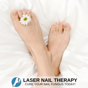 Toenail Fungus Laser Treatment in Carmichael, CA Best Toenail Fungus Treatment in San Antonio, TX