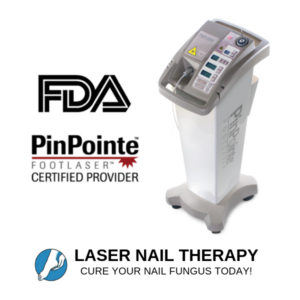 Toenail Fungus Laser Treatment in Valrico, FL Choose Laser Treatment for Toenail fungus