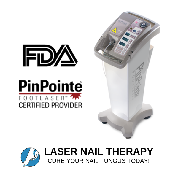 Toenail Fungus treatment benefits Laser Nail Therapy toenail fungus laser treatment