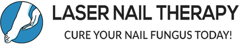 Breaking the Cycle: What Causes Toe Nail Fungus Relapse? Laser Nail Therapy