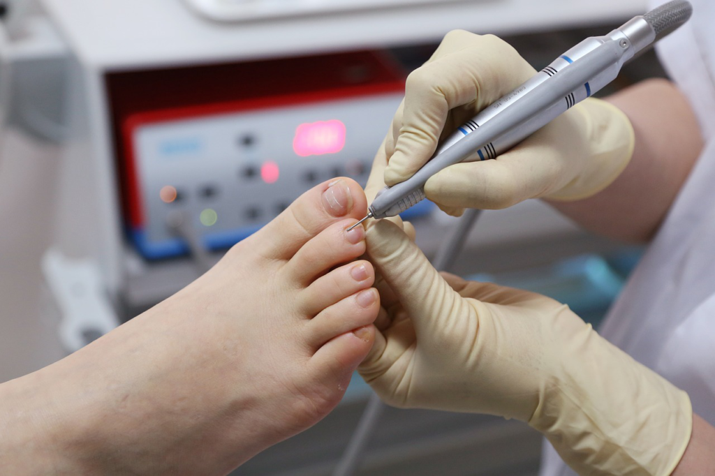Step into the Future: Modern Treatments for Toenail Fungus, Including Lasers Podiatrist Performing Nail Care