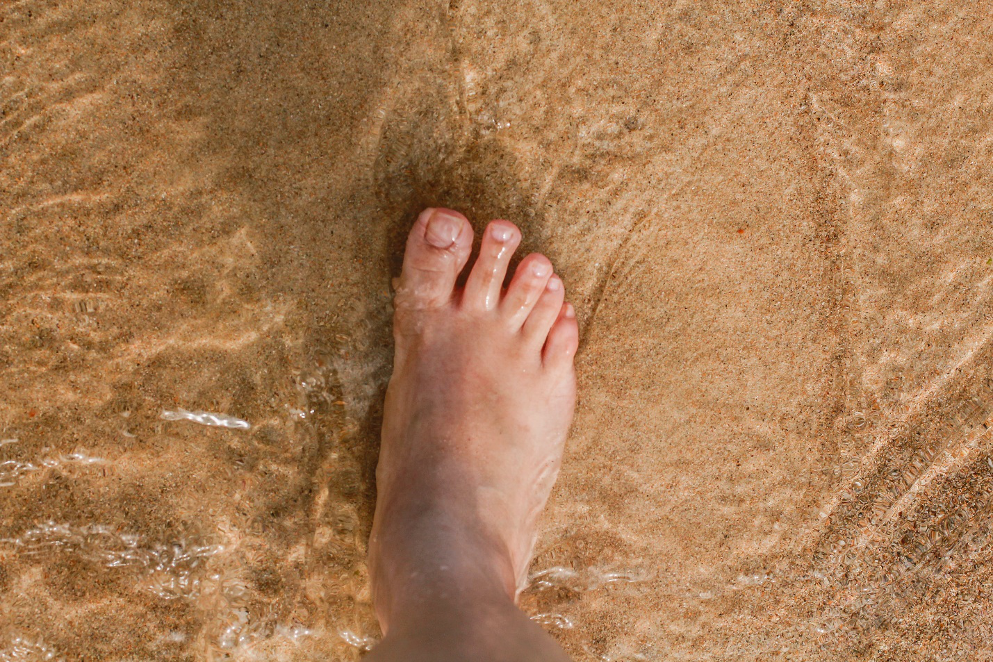 Debunking Common Myths About Toenail Fungus and Laser Treatment Person’s Feet After Toenail Fungus Treatment